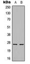 Cerebellin 3 Precursor antibody, LS-C358438, Lifespan Biosciences, Western Blot image 