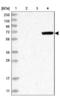 Mannan Binding Lectin Serine Peptidase 2 antibody, NBP1-81259, Novus Biologicals, Western Blot image 