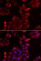 PDZ And LIM Domain 1 antibody, orb247565, Biorbyt, Immunocytochemistry image 