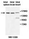Alanine--Glyoxylate Aminotransferase 2 antibody, orb77524, Biorbyt, Western Blot image 
