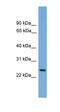 Proteasome Activator Subunit 2 antibody, orb330848, Biorbyt, Western Blot image 