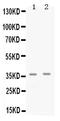 Cyclin Dependent Kinase 6 antibody, PB9995, Boster Biological Technology, Western Blot image 