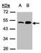 Acylglycerol Kinase antibody, PA5-28566, Invitrogen Antibodies, Western Blot image 