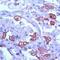 Keratin 8 antibody, PA1-37987, Invitrogen Antibodies, Immunohistochemistry frozen image 