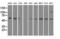 CD4 antibody, GTX84720, GeneTex, Western Blot image 