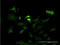 Neurotrophic Receptor Tyrosine Kinase 3 antibody, LS-C197807, Lifespan Biosciences, Immunofluorescence image 