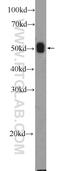 8-Oxoguanine DNA Glycosylase antibody, 15125-1-AP, Proteintech Group, Western Blot image 