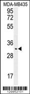 Olfactory Receptor Family 4 Subfamily K Member 2 antibody, 56-119, ProSci, Western Blot image 