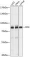 Radixin antibody, 15-723, ProSci, Western Blot image 