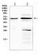 TNF Receptor Superfamily Member 1A antibody, A00294, Boster Biological Technology, Western Blot image 