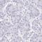 HGF Activator antibody, HPA058279, Atlas Antibodies, Immunohistochemistry paraffin image 