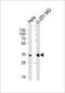 TATA-Box Binding Protein Associated Factor 8 antibody, PA5-48572, Invitrogen Antibodies, Western Blot image 