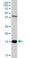 Hemoglobin Subunit Zeta antibody, H00003050-D01P, Novus Biologicals, Western Blot image 