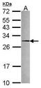 Peroxiredoxin 4 antibody, GTX116414, GeneTex, Western Blot image 