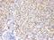 Adenosine Kinase antibody, PB10031, Boster Biological Technology, Immunohistochemistry frozen image 