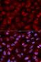 CD47 Molecule antibody, LS-C331720, Lifespan Biosciences, Immunofluorescence image 