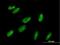 Zinc Finger And BTB Domain Containing 22 antibody, H00009278-B01P, Novus Biologicals, Immunocytochemistry image 