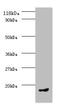 C-C motif chemokine 5 antibody, LS-C285656, Lifespan Biosciences, Western Blot image 