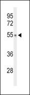 DiGeorge Syndrome Critical Region Gene 2 antibody, PA5-26463, Invitrogen Antibodies, Western Blot image 