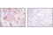 Ezrin antibody, 3142P, Cell Signaling Technology, Immunohistochemistry paraffin image 