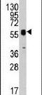 Thymidine Phosphorylase antibody, PA5-14179, Invitrogen Antibodies, Western Blot image 