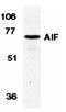ADAM Metallopeptidase Domain 12 antibody, orb18958, Biorbyt, Western Blot image 