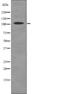 Receptor Tyrosine Kinase Like Orphan Receptor 2 antibody, PA5-64808, Invitrogen Antibodies, Western Blot image 