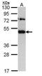 Translocating chain-associated membrane protein 1 antibody, GTX108535, GeneTex, Western Blot image 