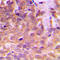Signal Transducer And Activator Of Transcription 5A antibody, LS-C354259, Lifespan Biosciences, Immunohistochemistry paraffin image 