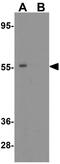 Sequestosome 1 antibody, GTX31795, GeneTex, Western Blot image 