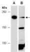 Bromodomain Adjacent To Zinc Finger Domain 2B antibody, R0189-4, Abiocode, Western Blot image 