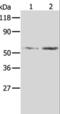 Aldose reductase antibody, LS-C400454, Lifespan Biosciences, Western Blot image 