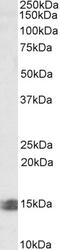 Methylenetetrahydrofolate Reductase antibody, 42-160, ProSci, Enzyme Linked Immunosorbent Assay image 