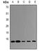 Ubiquitin Conjugating Enzyme E2 D4 (Putative) antibody, orb382104, Biorbyt, Western Blot image 