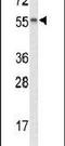 Nyctalopin antibody, PA5-26492, Invitrogen Antibodies, Western Blot image 