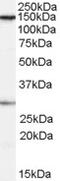 Non-SMC Condensin I Complex Subunit H antibody, 45-724, ProSci, Western Blot image 