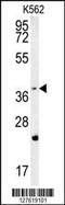 F-Box And WD Repeat Domain Containing 12 antibody, 55-114, ProSci, Western Blot image 