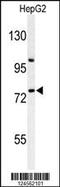 Zinc Finger Protein 202 antibody, TA325114, Origene, Western Blot image 