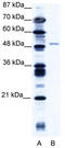 Zinc Finger Protein 627 antibody, TA337900, Origene, Western Blot image 