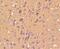 S100 Calcium Binding Protein B antibody, NBP2-67572, Novus Biologicals, Immunohistochemistry paraffin image 