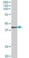 Rabaptin, RAB GTPase Binding Effector Protein 2 antibody, H00079874-B01P, Novus Biologicals, Western Blot image 