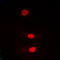 Polo Like Kinase 1 antibody, LS-C368472, Lifespan Biosciences, Immunofluorescence image 
