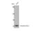 Homeobox A11 antibody, STJ93575, St John