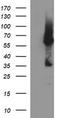 Tyrosine Hydroxylase antibody, TA506557, Origene, Western Blot image 