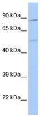Zinc Finger Protein 585B antibody, TA341467, Origene, Western Blot image 