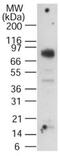 CXXC Finger Protein 1 antibody, GTX13695, GeneTex, Western Blot image 