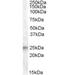 Insulin Like Growth Factor Binding Protein 6 antibody, orb19859, Biorbyt, Western Blot image 