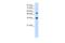 Homeobox C11 antibody, A08258, Boster Biological Technology, Western Blot image 