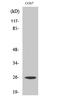 Eukaryotic Translation Initiation Factor 4E antibody, STJ92881, St John