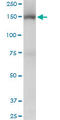 Tripartite Motif Containing 33 antibody, LS-C133759, Lifespan Biosciences, Western Blot image 